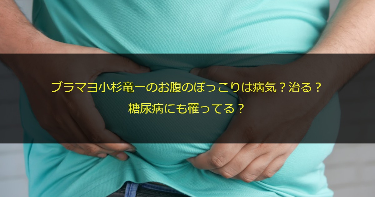 ブラマヨ小杉竜一のお腹のぽっこりは病気？治る？糖尿病にも罹ってる？